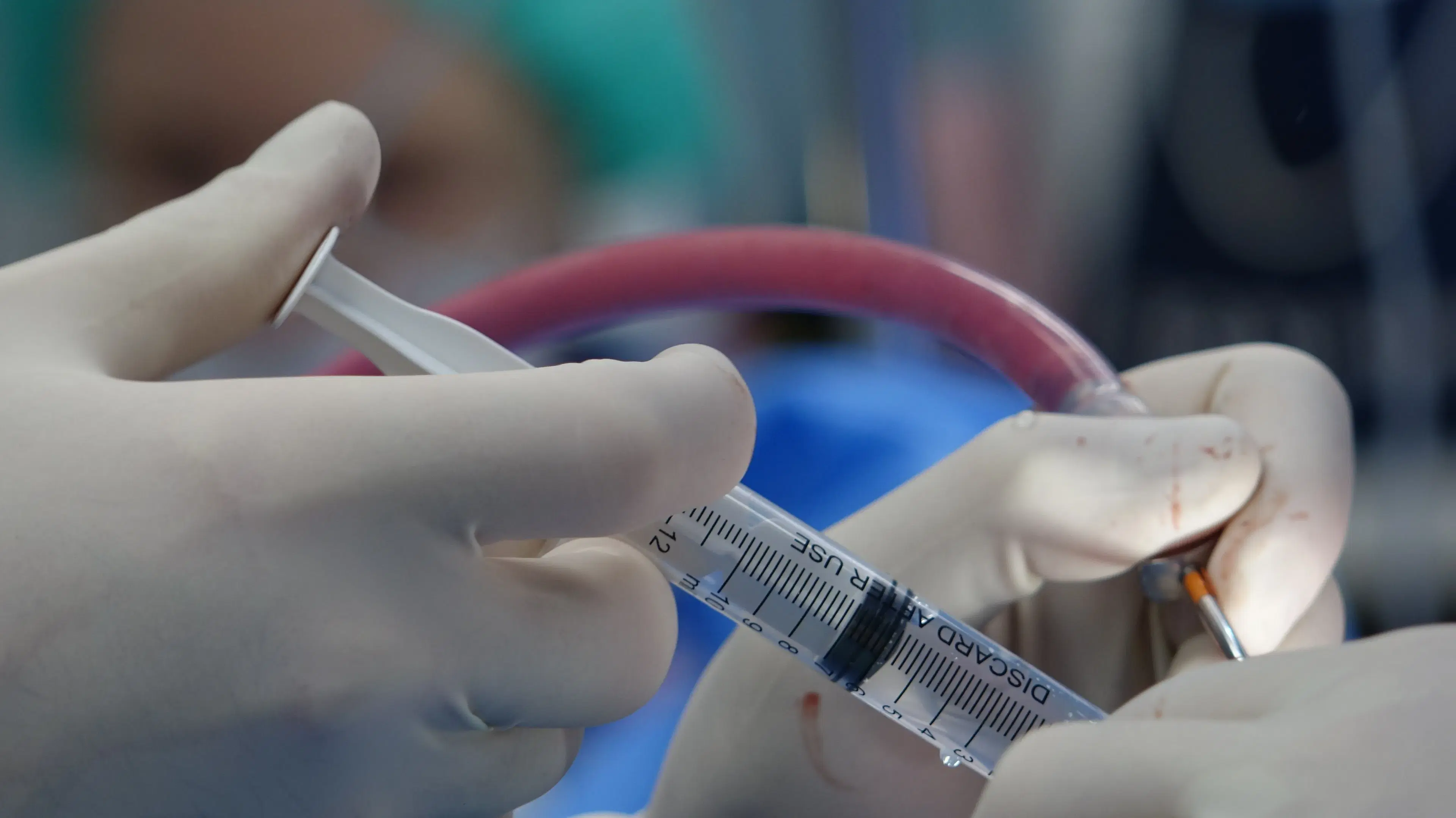 Stentless Angioplasty: Drug-Eluting Balloon Strategy in Selected Heart Attack Patients