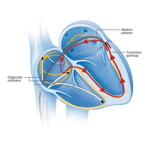 Arrhythmia Clinic