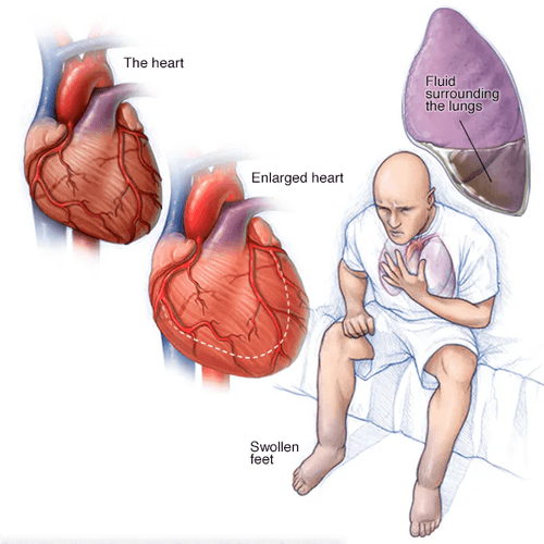 Heart Muscle Clinic