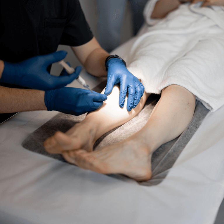 Sclerotherapy